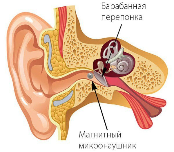 почему не работает микронаушник магнит меня слышат а я нет. Смотреть фото почему не работает микронаушник магнит меня слышат а я нет. Смотреть картинку почему не работает микронаушник магнит меня слышат а я нет. Картинка про почему не работает микронаушник магнит меня слышат а я нет. Фото почему не работает микронаушник магнит меня слышат а я нет